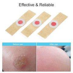 Corn Remover Pads Pack of 24